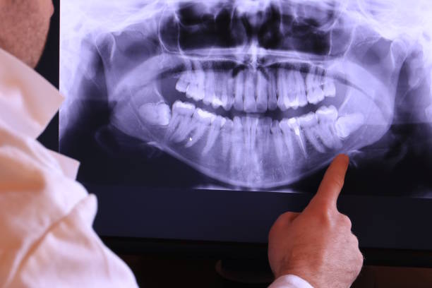 Best Emergency Dental Services for Seniors in Richlandtown, PA
