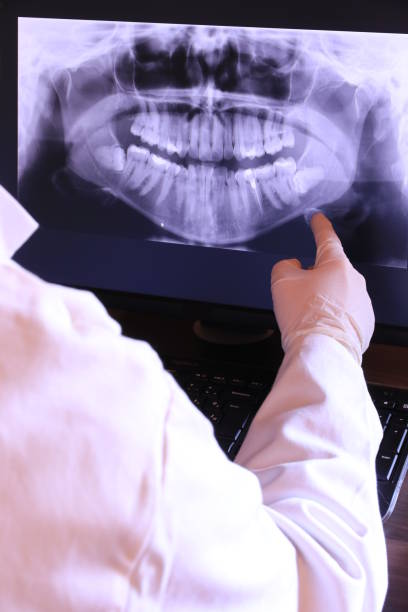 Best Emergency Dentist for Knocked-Out Tooth in Richlandtown, PA